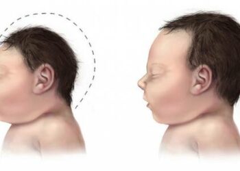 AMERICA/CUBA - Zika virus continues to spread, 30 countries in Latin America already affected