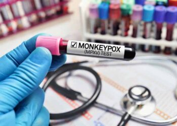 Monkeypox update: Man with travel history to Peru, one of two new cases