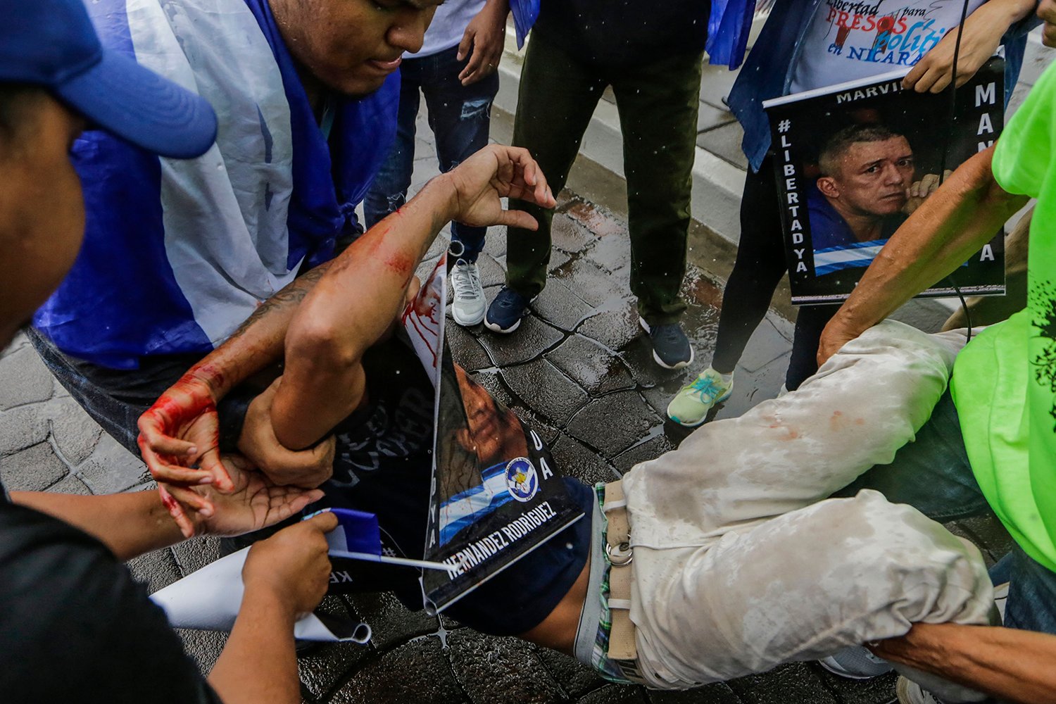 A protester who has just been hit by a rubber bullet sprawls on the pavement as he's lowered by the arms of other demonstrators, with his own arms raised to shield his head. Some blood is visible on the man's arms and pants.