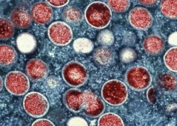 Rise in mpox cases is 'super concerning,' doctor says