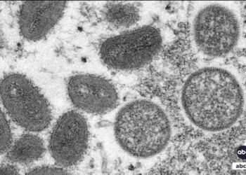 United States' first known case of more severe strain of mpox is confirmed in California