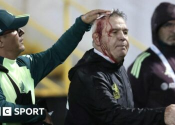 Mexico coach Javier Aguirre with blood pouring down his face after being hit by a can of beer following a game against Honduras