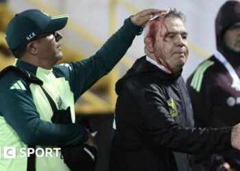 Javier Aguirre is treated with blood running down his face