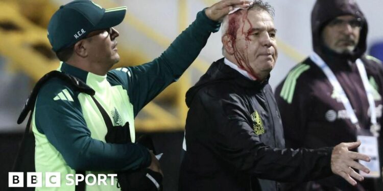 Javier Aguirre is treated with blood running down his face