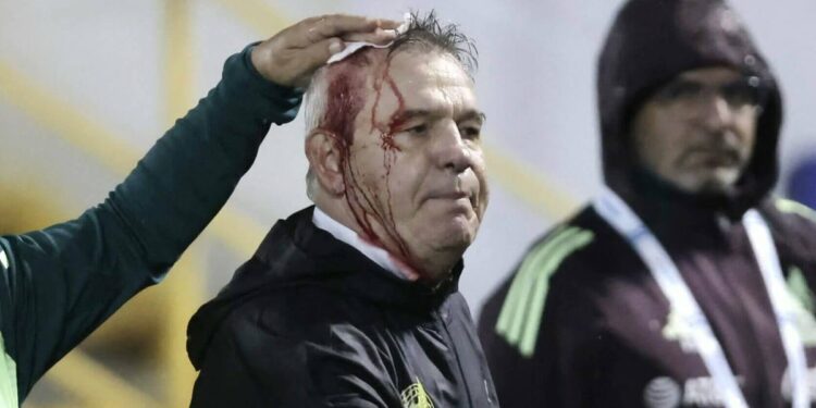 Mexico head coach Javier Aguirre struck by projectile, bloodied after Honduras game