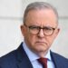 Prime Minister Anthony Albanese has shrugged off calls to take the chance to meet with president-elect Donald Trump on his upcoming overseas trip, bluntly saying Florida is "not on the way". Picture: NewsWire / Martin Ollman.
