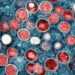 United States’ first known case of more severe strain of mpox confirmed in California
