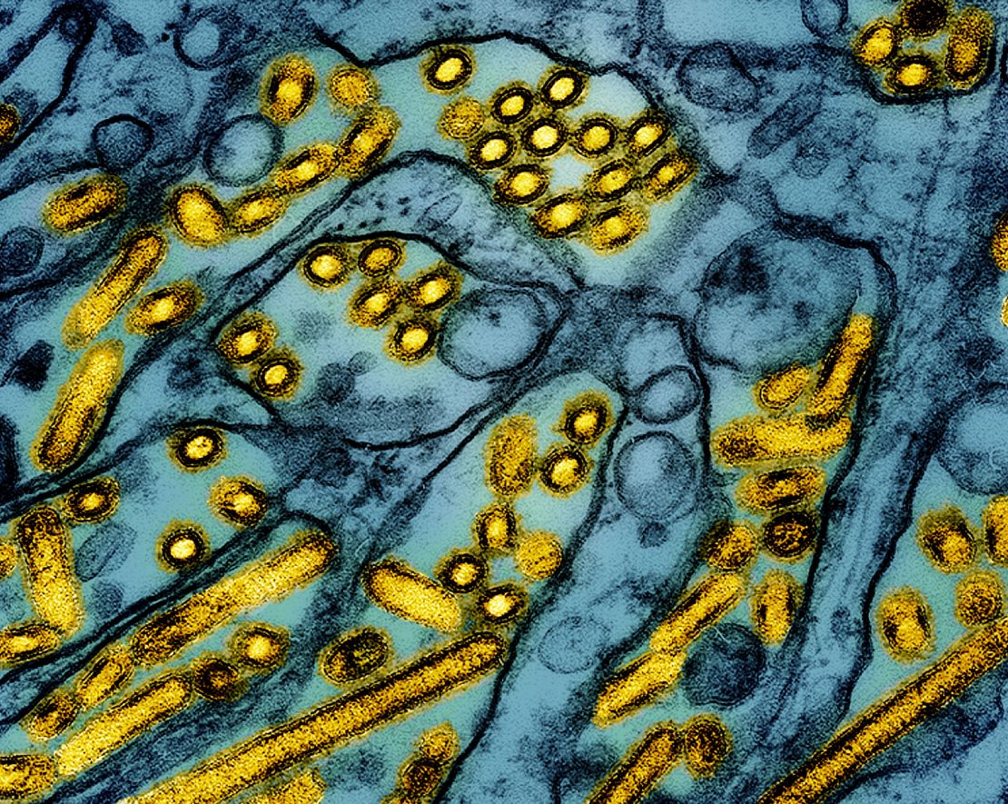 Avian influenza A H5N1 virus particles are shown in yellow.