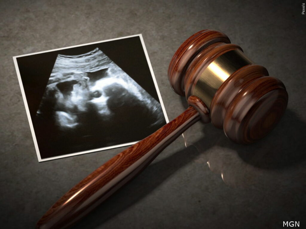 Arizona health care providers file lawsuit to challenge an abortion ban