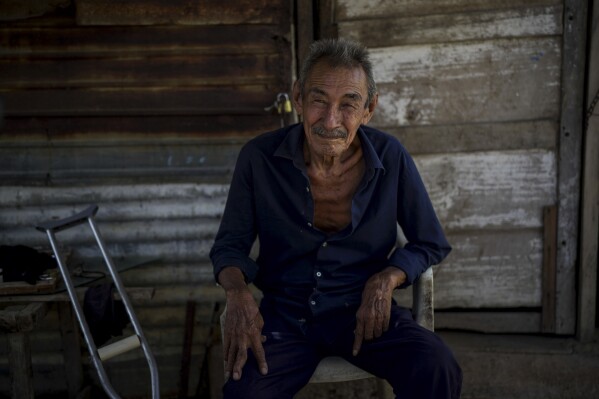 Alfredo Atencio, 69, poses for the photo at home in the Amanecer de la Paz neighborhood, on the outskirts of Maicao, Colombia, Wednesday, Feb. 5, 2025. (AP Photo/Ivan Valencia)