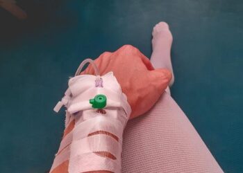 Injured American eels (Anguilla rostrata) are frequently encountered in… – ResearchGate