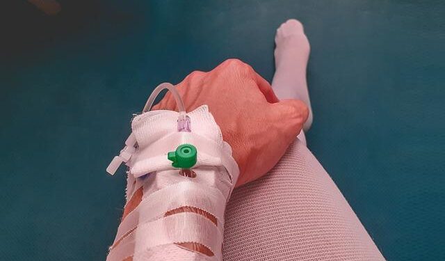 Injured American eels (Anguilla rostrata) are frequently encountered in… – ResearchGate