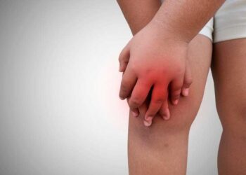 ‘Walk to Cure Juvenile Arthritis’ at Mall of America on April 26 – kare11.com