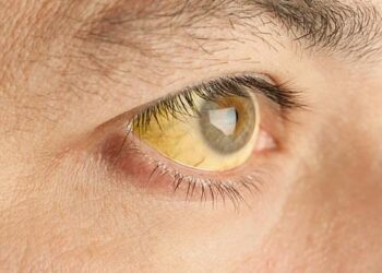 Colombia’s Fight for Survival: Confronting the Deadly Yellow Fever Outbreak