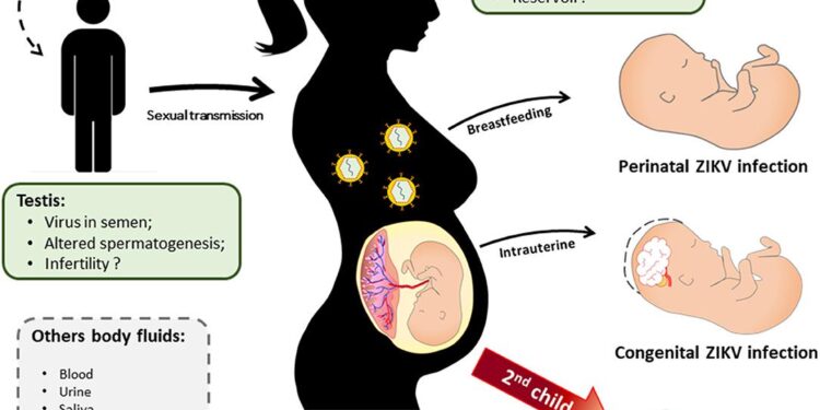 Unraveling the Effects of Zika Virus on Pregnancy Outcomes in the French Territories of the Americas