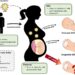 Unraveling the Effects of Zika Virus on Pregnancy Outcomes in the French Territories of the Americas