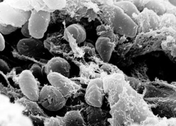 Heartbreaking Loss: Arizona Resident Succumbs to Pneumonic Plague