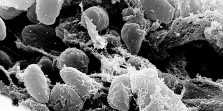 Heartbreaking Loss: Arizona Resident Succumbs to Pneumonic Plague