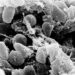 Heartbreaking Loss: Arizona Resident Succumbs to Pneumonic Plague