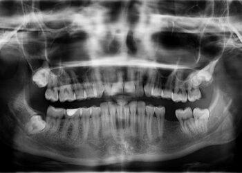 Desperate Hunt for Missing US Student Sudiksha Konanki in the Dominican Republic